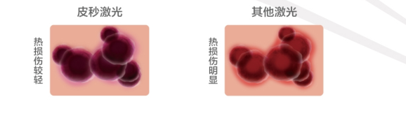 1480923147636795.png UXM{IA)H_PN)TP@45QU3Y{4.png